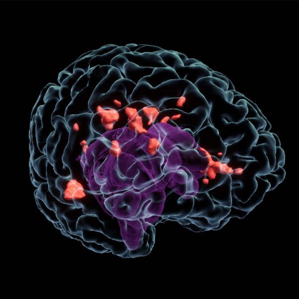 Graphic depicting the inside of a brain